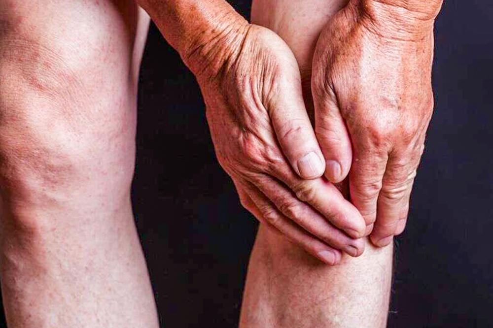 Osteoarthritis – Symptoms, Causes, Flare-Up Triggers & Treatment Options